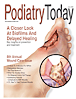 How to Get Better Results with Bunion Surgery