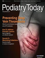 How to Treat the High Arched Cavus Foot