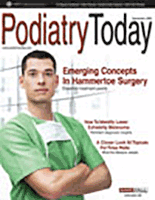 Current Concepts in Treating Achilles Tendon Ruptures