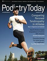Considering Ankle Replacement for Ankle Arthritis