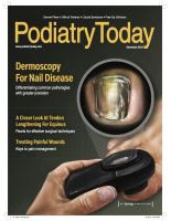 Tarsal Coalition: A Cause of Hindfoot Pain, Podiatry Today